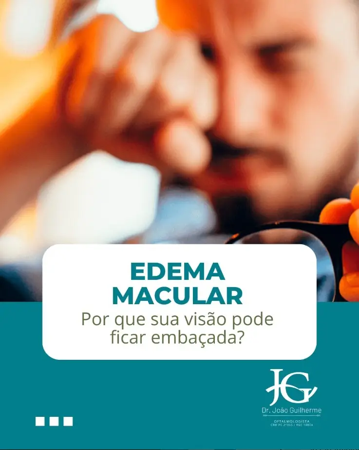 edema-macular-embaçada